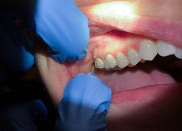 Best Urgent Care for Lost Fillings or Crowns in Concordia, MO